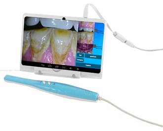 Intraoral video cameras