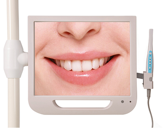 Intraoral camera + 17'' LCD Monitir