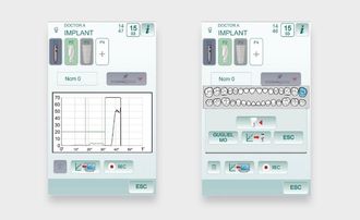 ANTHOS Torque Curves - ПЕРФЕКТНАТА ИНТЕГРАЦИЯ ЗА ИМПЛАНТОЛОГИЯТА 